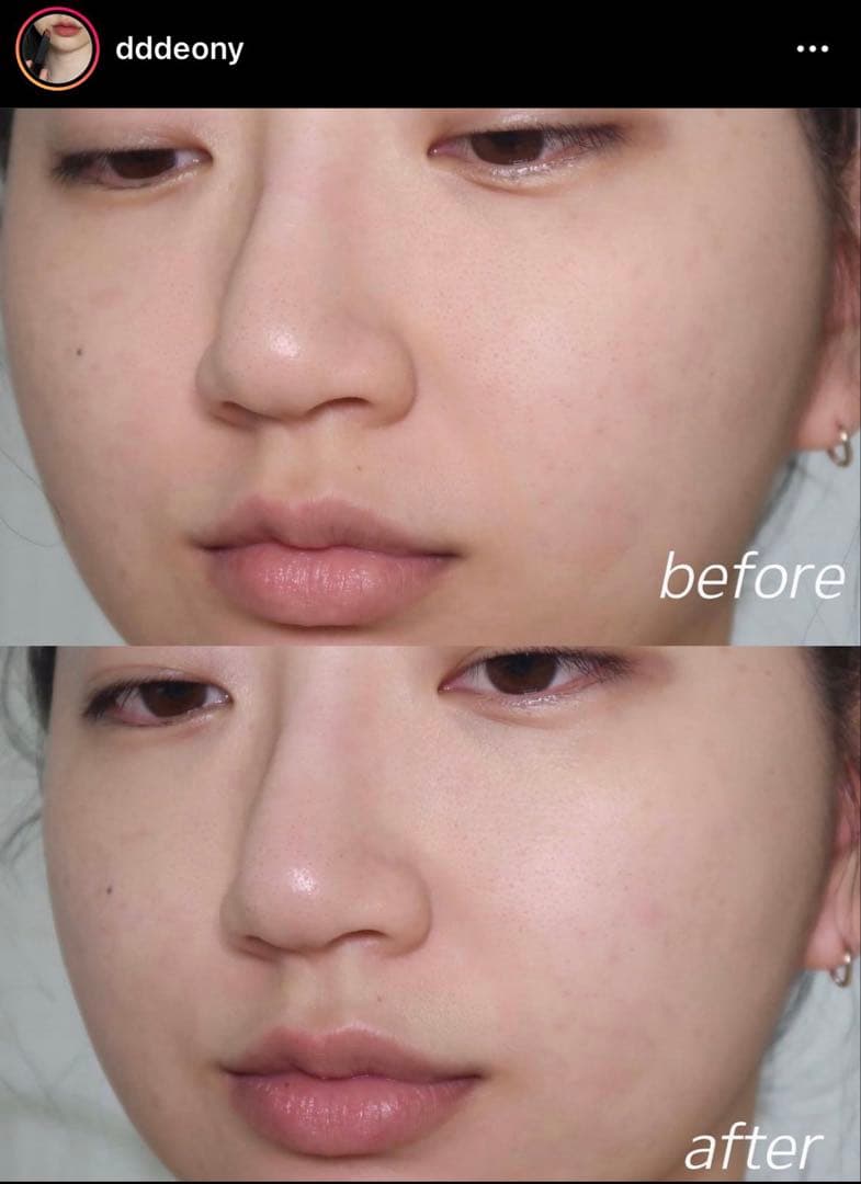 ISOI Blemish Care Serum 合計30ml — image 2