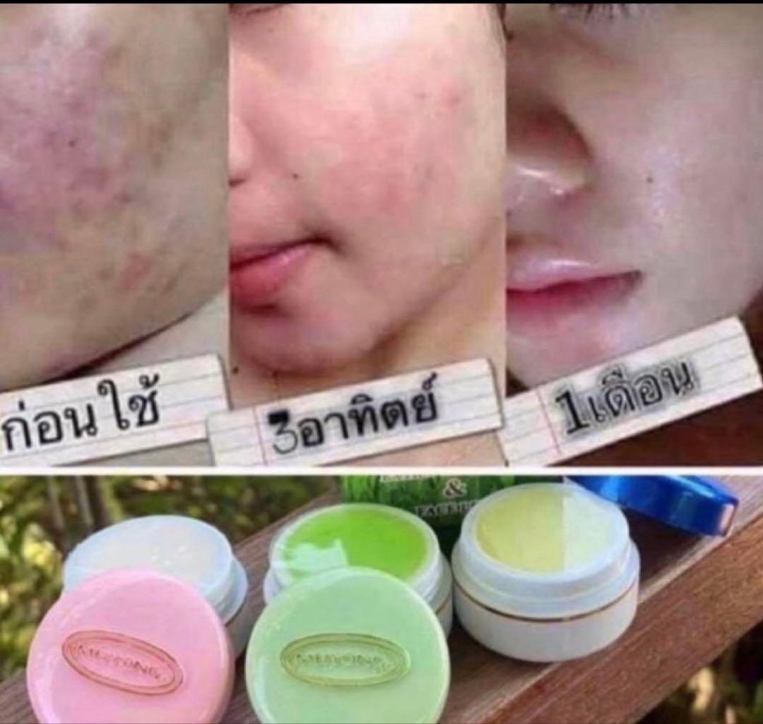 meyyong 2セット — image 2
