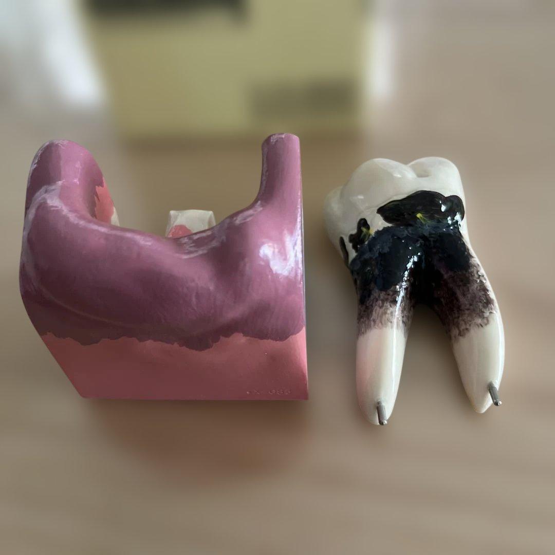 新品　歯の模型 — image 5