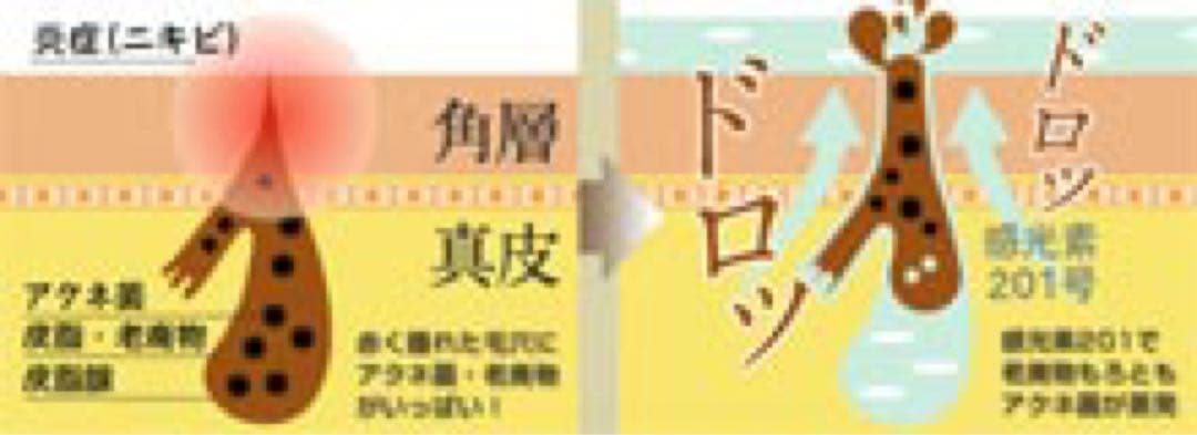 【容器キズ86%OFF】2個セットさらに割引 シミ取り美容液 レビウス シミ消し — image 5